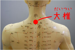 風邪予防のお灸‐大椎
