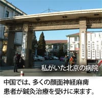 多くの顔面麻痺患者を治療