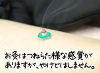 お灸治療