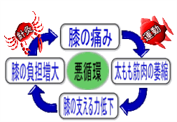 変形性膝関節症の鍼灸治療