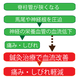 脊柱管狭窄症の改善図