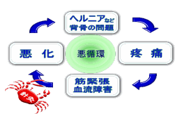 坐骨神経痛の悪循環図