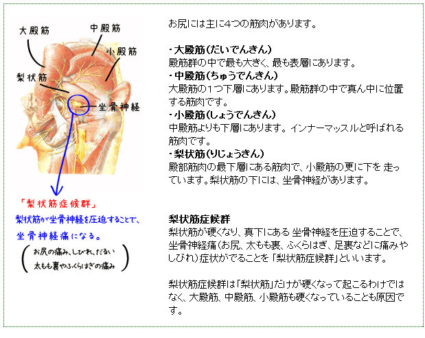 梨状筋