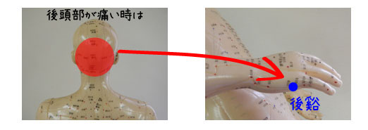 後頭部の頭痛とツボ