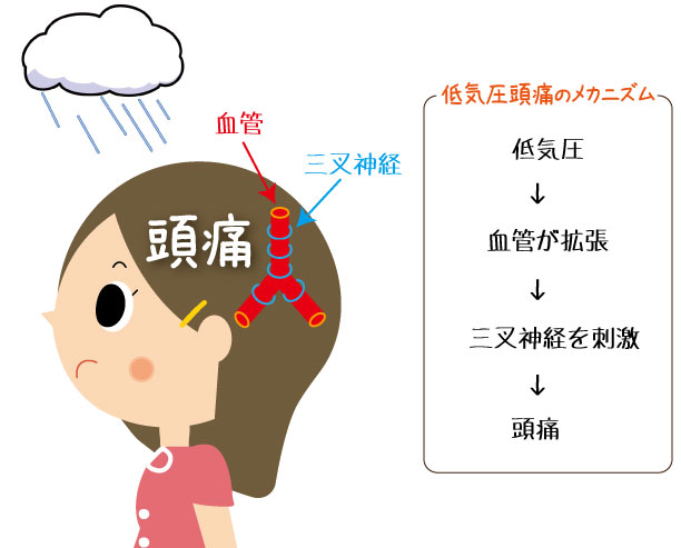 頭痛 気圧 低気圧で頭痛はウソか！？6大原因と8つの対処法から予防まで徹底解剖