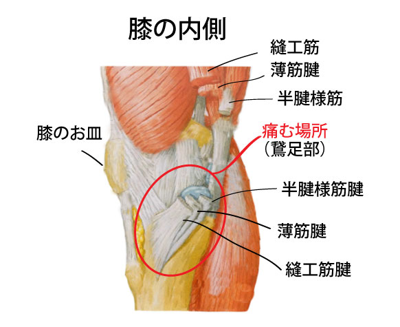 鵞足炎