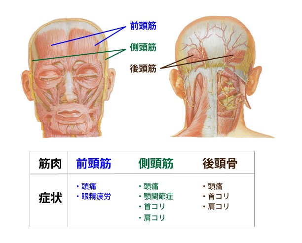 頭痛、眼精疲労と頭の筋肉のコリへの鍼灸｜福岡・天神の鍼灸院