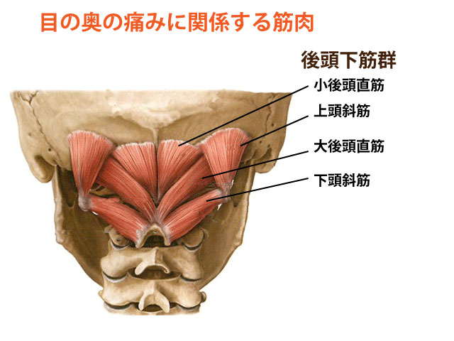 目の奥の痛みの鍼灸治療