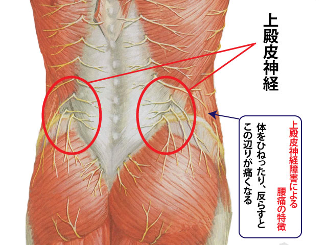 上殿皮神経障害による腰痛の鍼灸治療