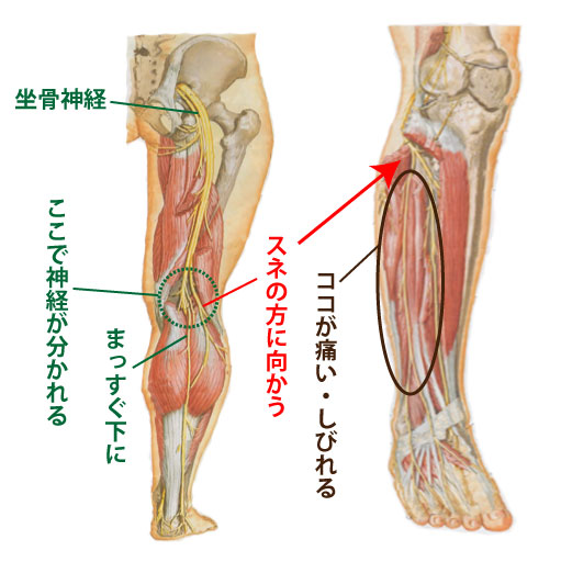 ふくらはぎ 外側 の 痛み