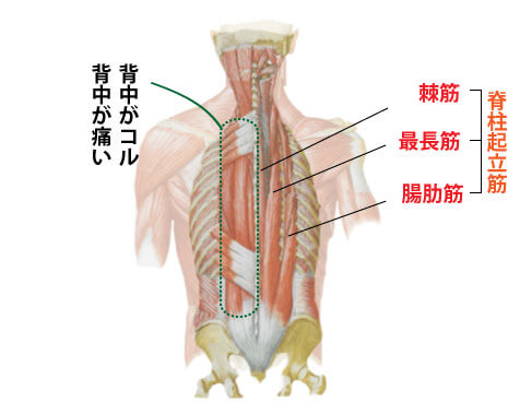 背中の痛み コリに効果的なツボと鍼灸 福岡市中央区天神の鍼灸院