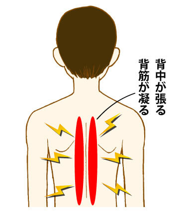 背中の痛み コリに効果的なツボと鍼灸 福岡市中央区天神の鍼灸院