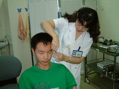 中国の眼科鍼灸治療