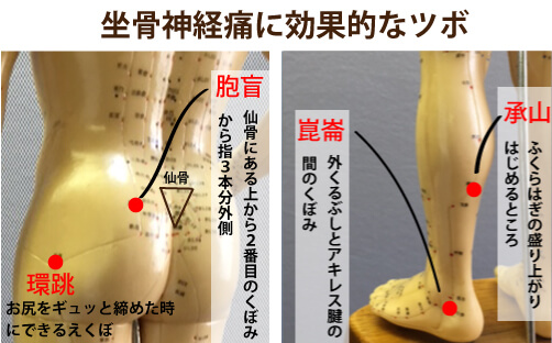 坐骨 神経痛 マッサージ ツボ