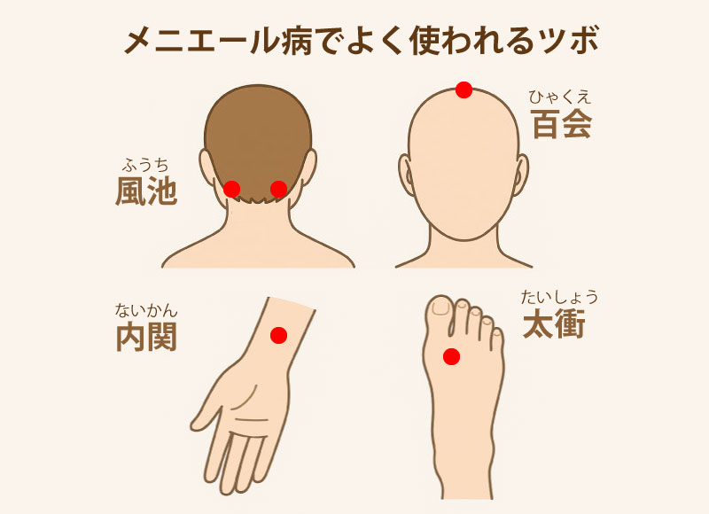 メニエール病でよく使われるツボ