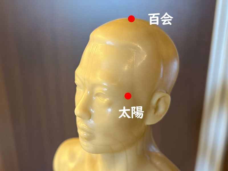 ツボ:百会、太陽