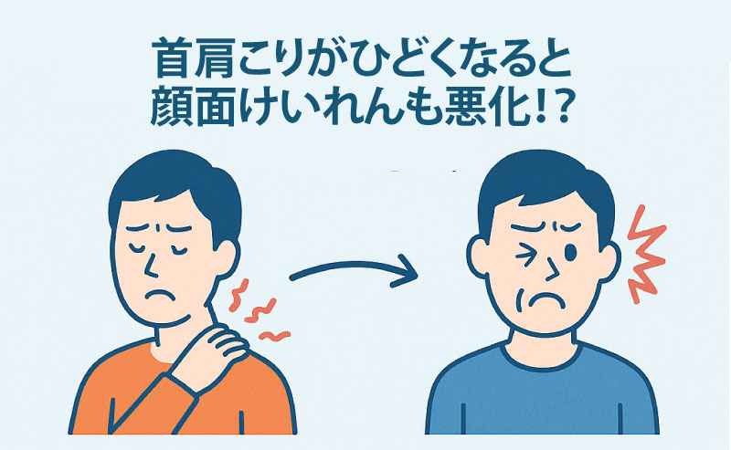 首肩こりがあると顔面痙攣が悪化