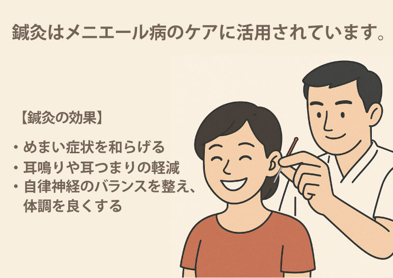メニエール病に鍼灸を活用