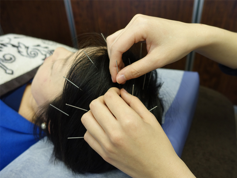 産後の抜け毛のイメージ