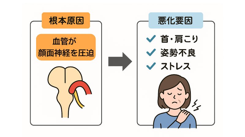 顔面痙攣悪化要因