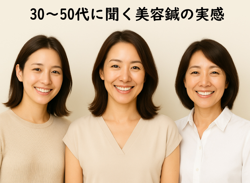 30代、40代、50代に効く美容鍼の実感