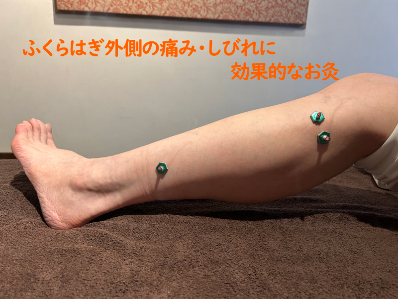 ふくらはぎ外側のツボにお灸