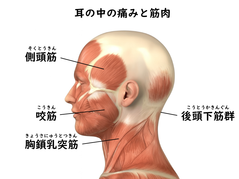 耳の痛みと関連する筋肉（側頭筋・咬筋・後頭下筋群・胸鎖乳突筋）