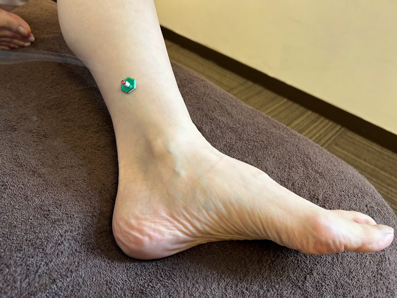 三陰交のお灸で生理痛緩和