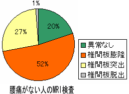 腰痛がなくても椎間板ヘルニア