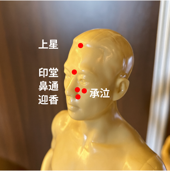 アレルギー性鼻炎のツボ
