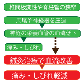 脊柱管狭窄症の改善図