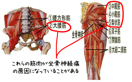 坐骨神経痛を引き起こす筋肉の紹介