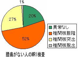 MRIの結果