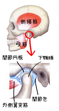 顎関節症　筋肉　関節