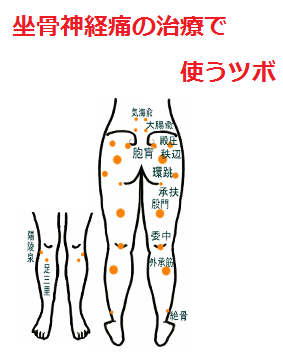 坐骨神経痛　ツボ