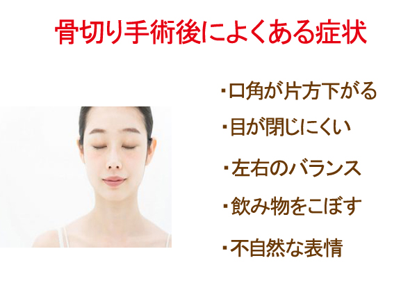 骨切り手術後の症状イメージ