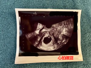 妊娠判定陽性の報告