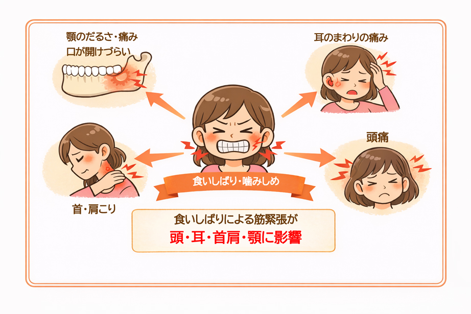 食いしばりによって起こる症状